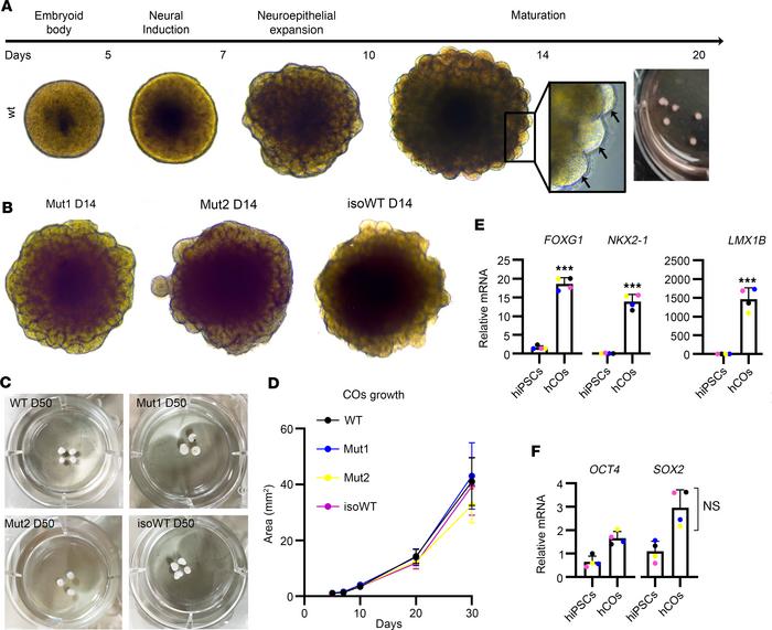 Generation and characterization of control and MCT8-deficient COs.
(A) S...