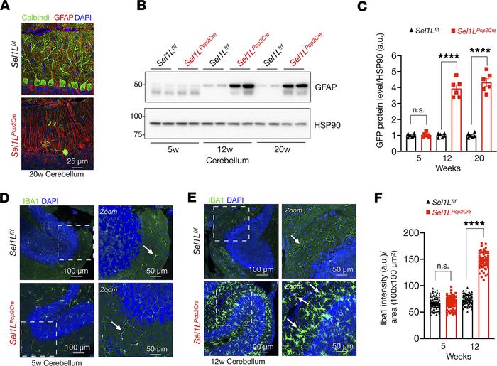 Elevated astrocyte activation and microglia proliferation in Sel1LPcp2Cr...
