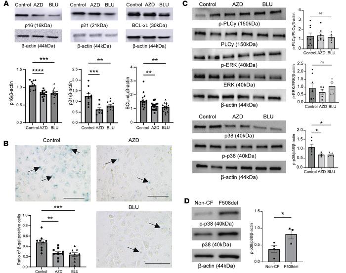 FGFR inhibition decreases cellular senescence markers and decreases phos...