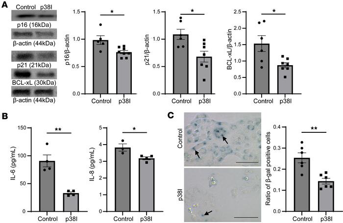 Inhibition of p38 MAPK decreases cellular senescence markers in CFBEs.
(...