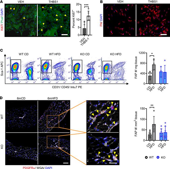 High-fat diet feeding causes THBS1-dependent FAP population expansion.
(...