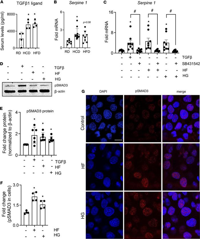 High-carbohydrate and -fat diets increase cell-intrinsic TGF-β signaling...