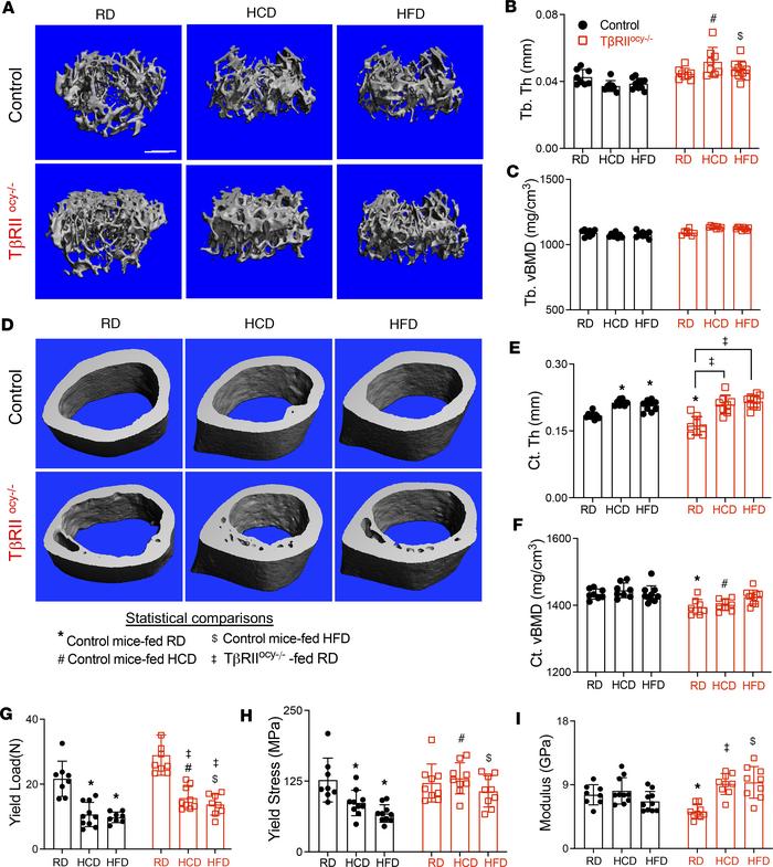 Disruption of TGF-β signaling in osteocytes prevents high-carbohydrate a...