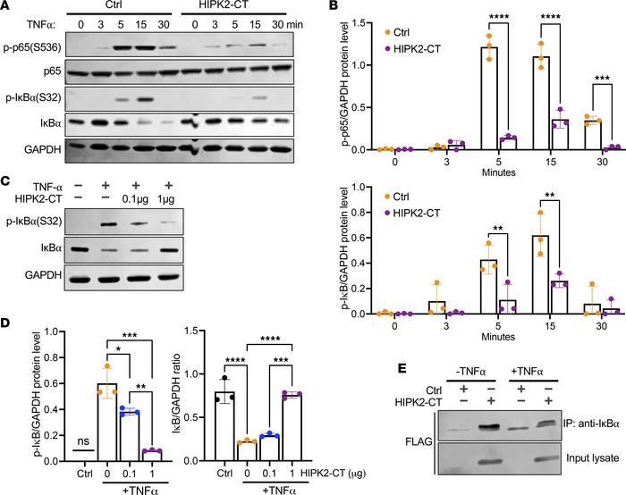 HIPK2-CT reduces TNF-induced p65 phosphorylation and IκB degradation.
(A...