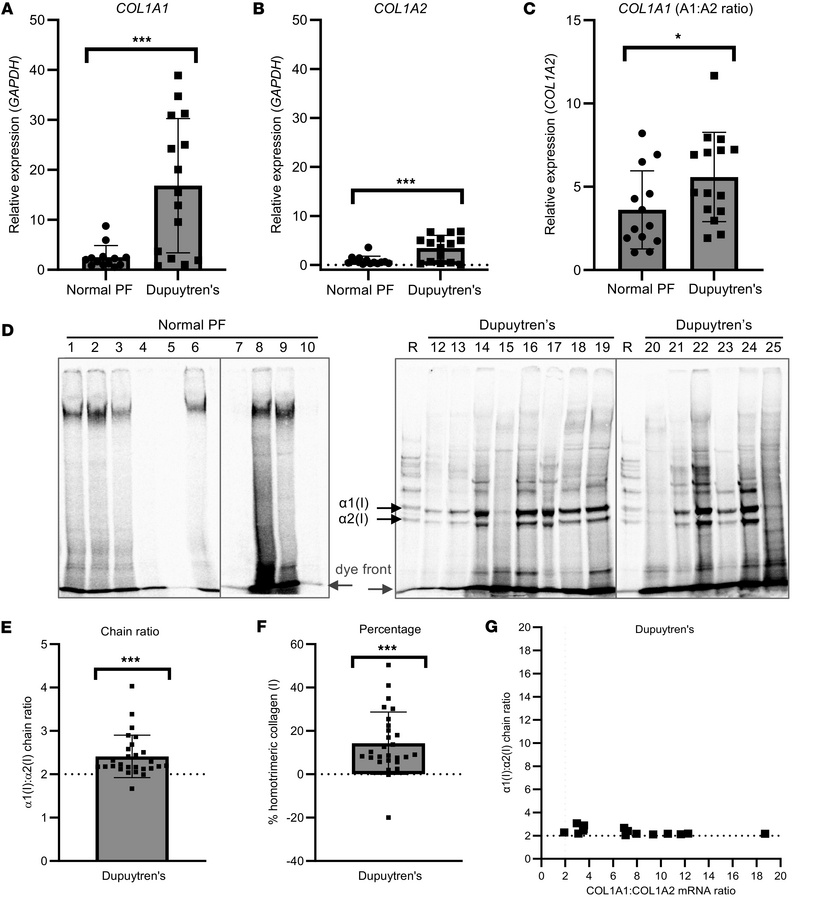 Synthesis of type I collagen homotrimer by Dupuytren’s tissue.
(A–C) Ana...