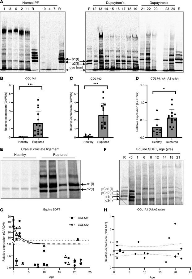 Type I collagen and proline-rich protein synthesis in tendon and ligamen...