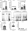 Synthesis of type I collagen homotrimer by Dupuytren’s tissue.