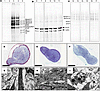 Normal palmar fascia and Dupuytren’s cells fully process procollagen, assem