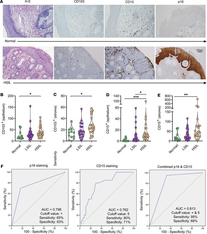 Detection of immunological biomarkers by immunohistochemistry.
(A) Examp...