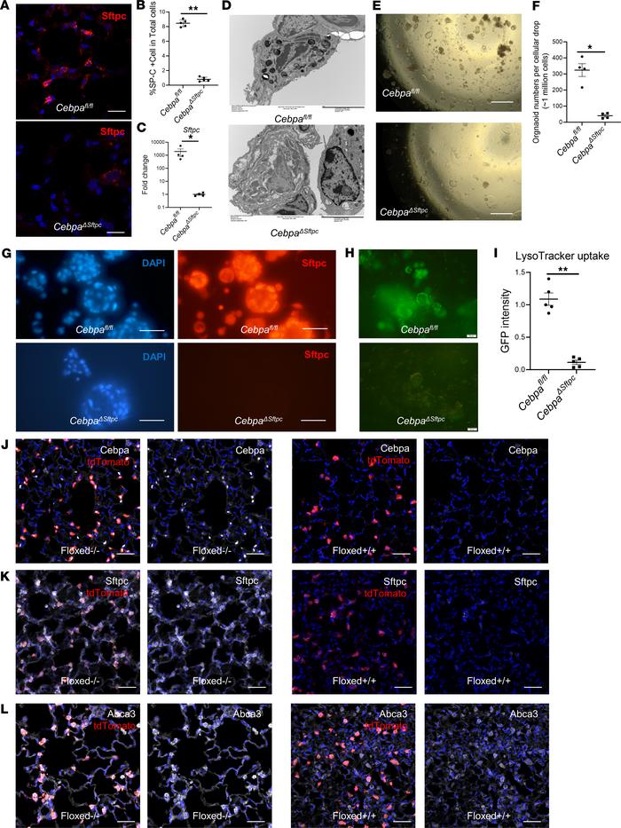 Loss of Cebpa induces loss of AT2 cell identity.
(A) Representative imag...