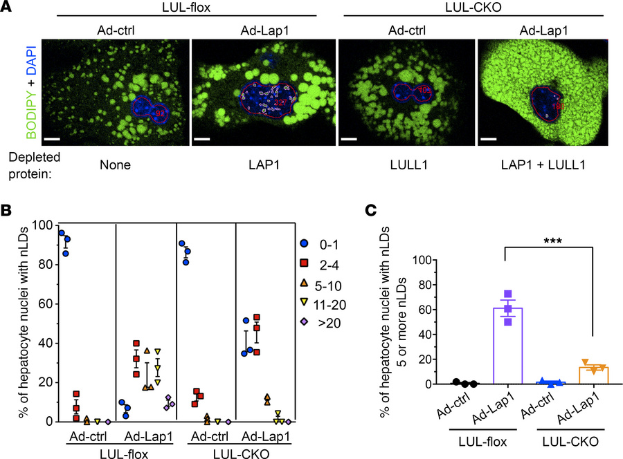 Nuclear lipid droplets in hepatocytes with depletion of LAP1, LULL1, or ...
