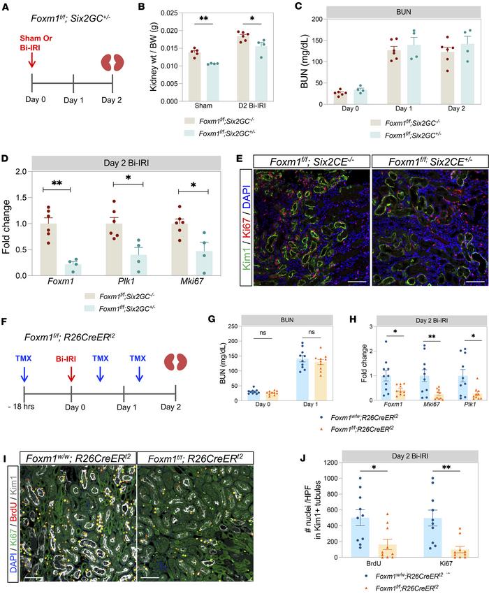 Nephron-specific and inducible, global deletion model to study Foxm1.
(A...