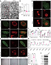 DAZAP1 enhances OXPHOS and maintains cell stemness in GC by inducing mitoph