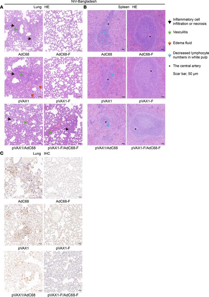 H&amp;E and IHC staining of lungs and spleens after challenge with NiV-B...