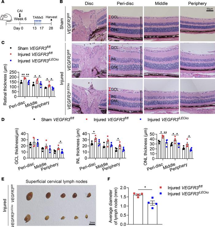 Inhibition of lymphangiogenesis alleviates CAI-induced retinal edema and...