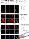 LECs in CAI-induced neolymphatics have a Prox1+, CDH5+, PDGFRβ–, and CX3CR1