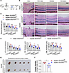 Inhibition of lymphangiogenesis alleviates CAI-induced retinal edema and en