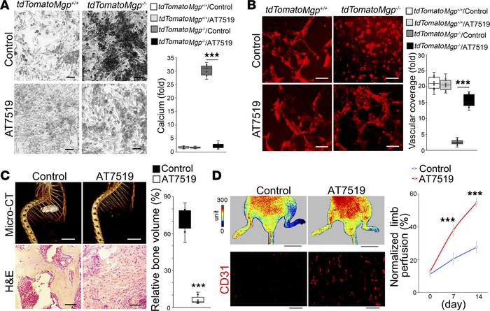 AT7519 prevents endothelial lineage cells from acquiring osteogenic capa...