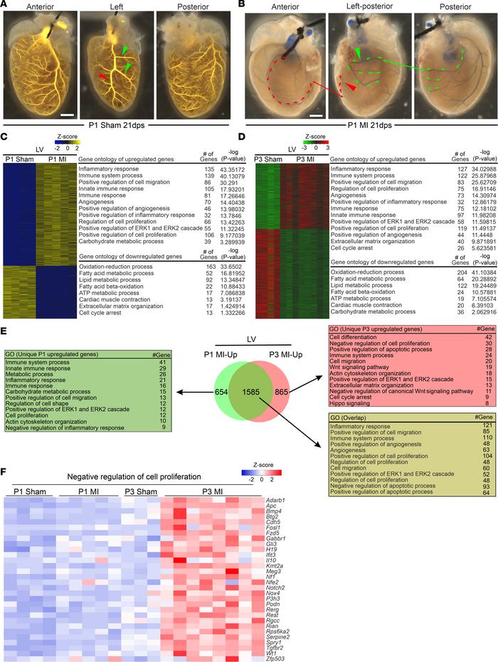 Atypical revascularization in P1 MI hearts; transcriptome analysis of th...