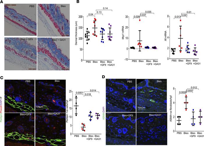 Pharmacological inhibition of TREM-1 prevents early loss of dermal adipo...
