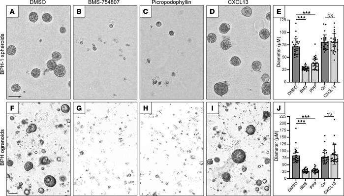 Inhibition of IGF1 signaling abolishes BPH spheroid and organoid formati...