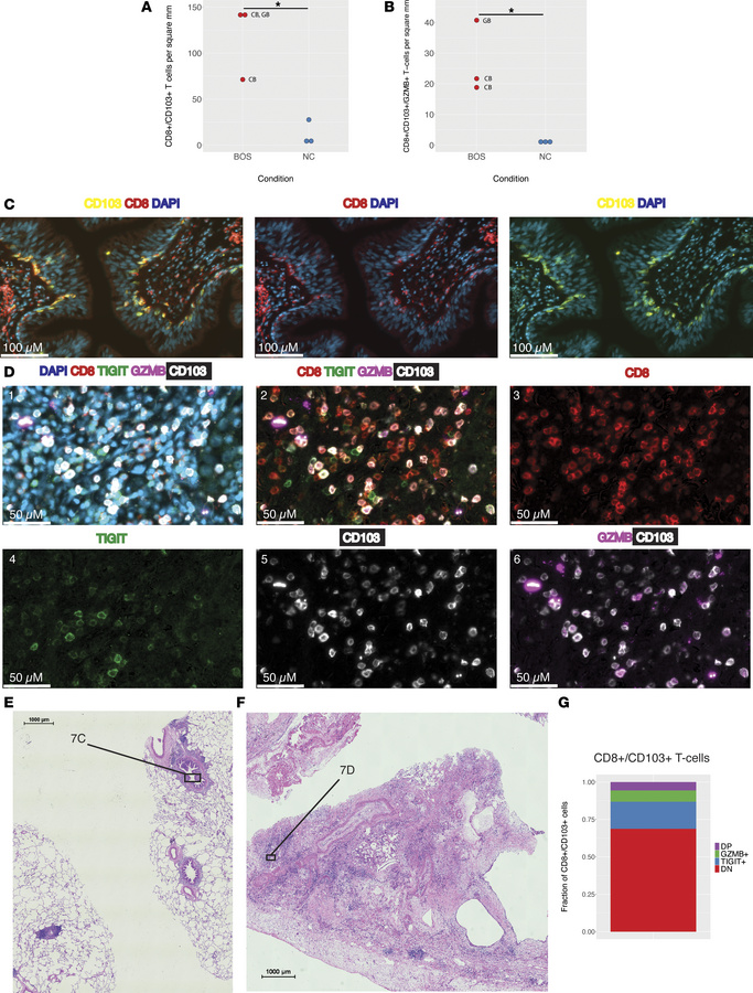 Multiplex immunofluorescence (mIF) imaging confirms expansion of TRM in ...