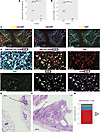Multiplex immunofluorescence (mIF) imaging confirms expansion of TRM in BOS