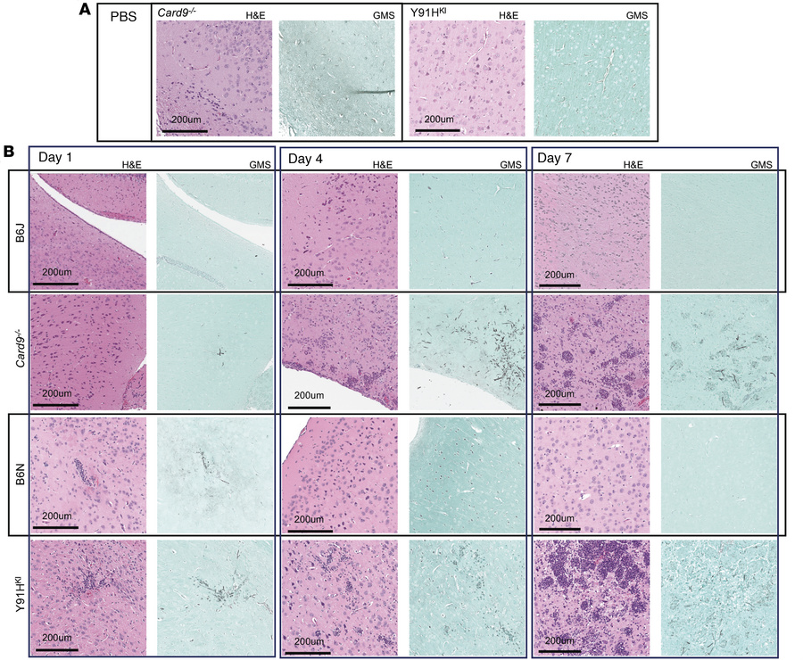 CARD9-deficient mice have increasing inflammatory responses in the brain...