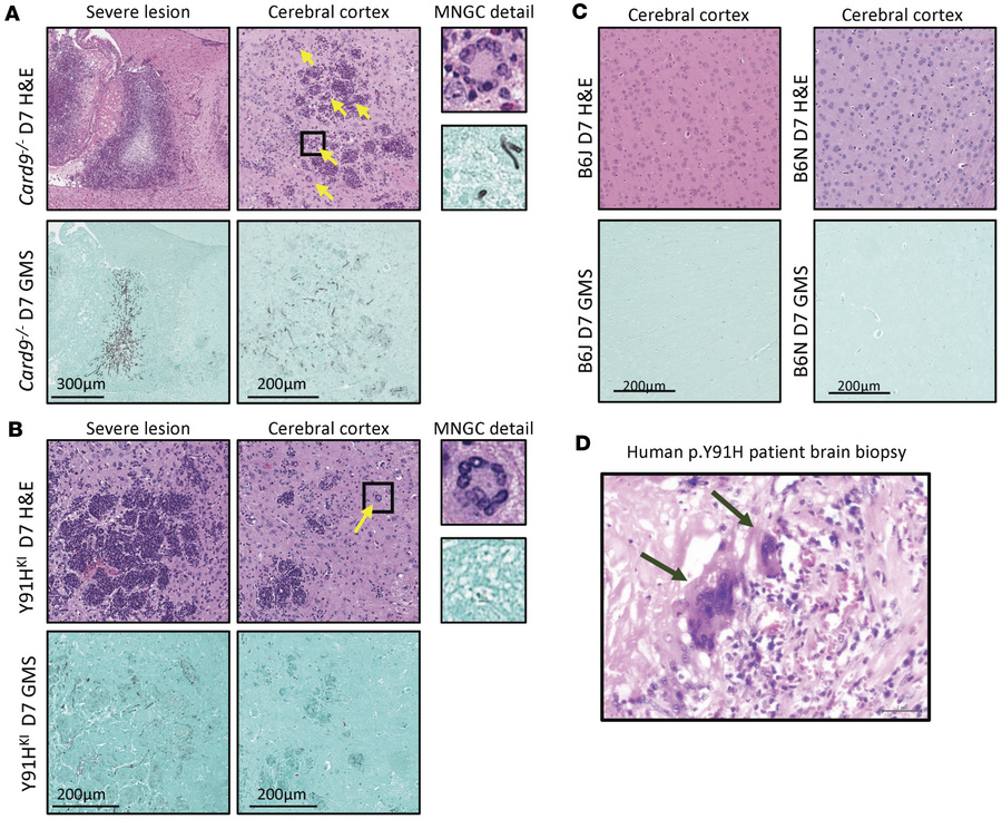 CARD9-deficient mice develop granulomatous inflammation with multinuclea...