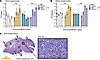 p.Y91H permits enhanced fungal growth in tissue and phenocopies Card9–/– mi