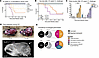 Low-dose i.v. inoculation as a model of chronic CNS candidiasis caused by C