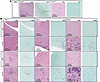 CARD9-deficient mice have increasing inflammatory responses in the brain du