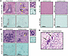 CARD9-deficient mice develop granulomatous inflammation with multinucleated