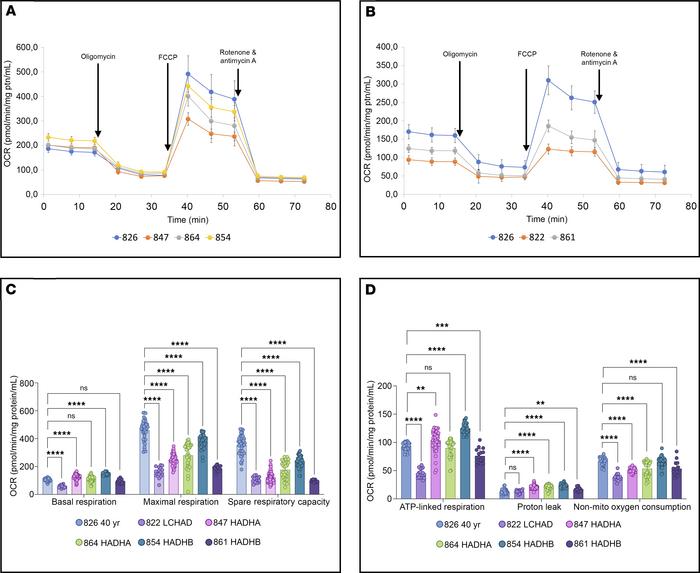 Mitochondrial bioenergetics parameters of TFP/LCHAD-deficient fibroblast...