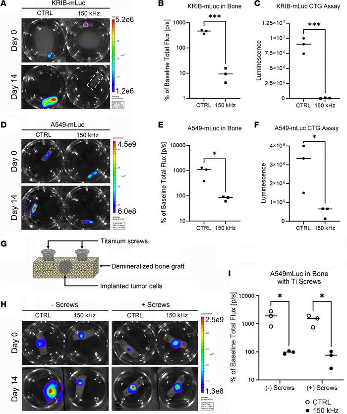 Effect of TTFields on tumor cell growth in 3D bone graft tumor model, wi...