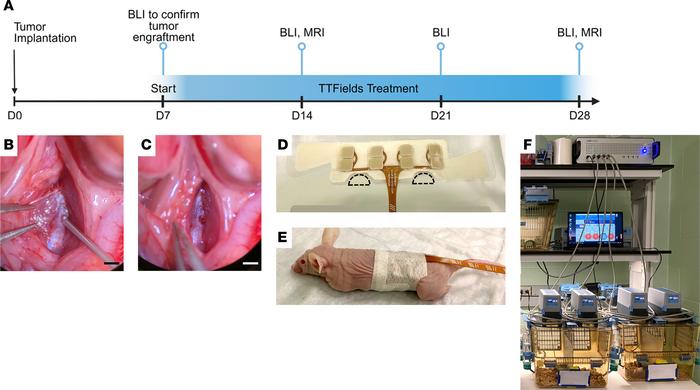 In vivo tumor implantation and TTFields or sham control (heat) delivery....