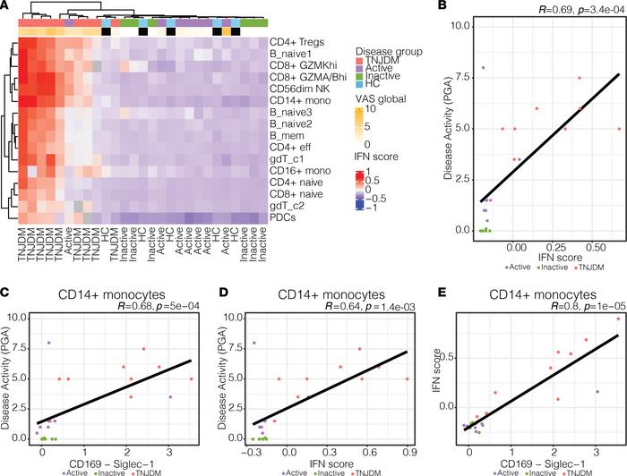 Type I IFN–induced gene and protein expression is associated with diseas...