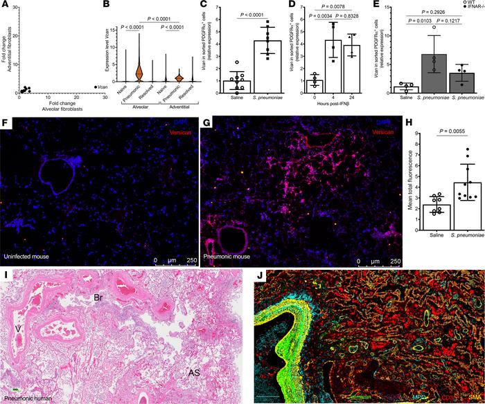 Fibroblasts increase versican expression and production in response to t...
