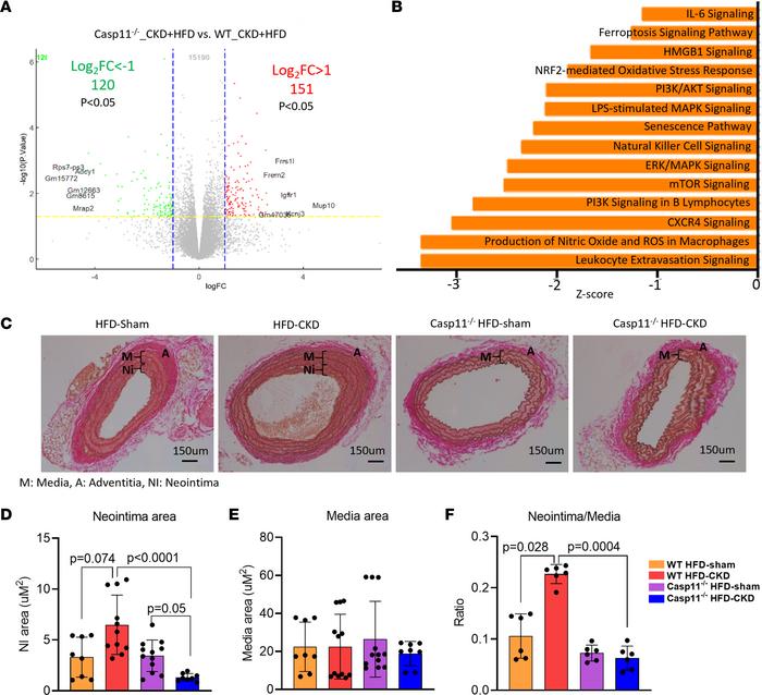 Caspase-11 deficiency decrease the formation of neointima in aortas of H...