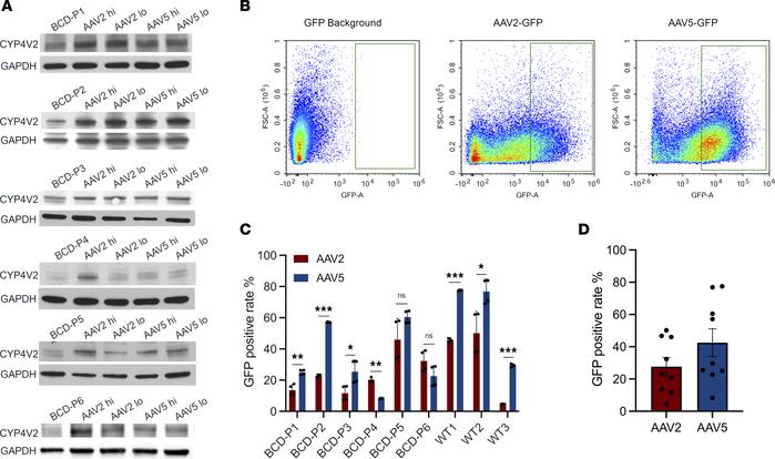 Distinct AAV transduction rate from iRPE of individual patients with BCD...