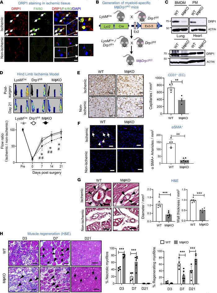 Myeloid Drp1KO mice exhibited impaired reparative neovascularization via...