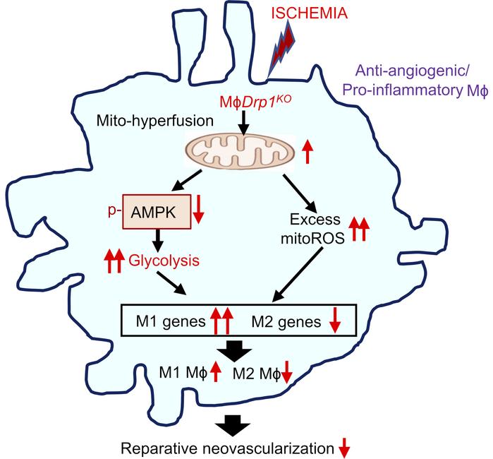 Schematic model illustrating that DRP1 deficiency in macrophages under i...