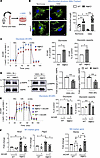 Drp1KO BMDMs under HSS exhibited mitochondrial hyperfusion and hyperglycoly