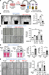 Conditioned medium (CM) from HSS-stimulated WT BMDMs, but not from Drp1KO B