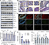Inhibition of EZH2 promotes immune infiltration and activation in VCMsh2THu