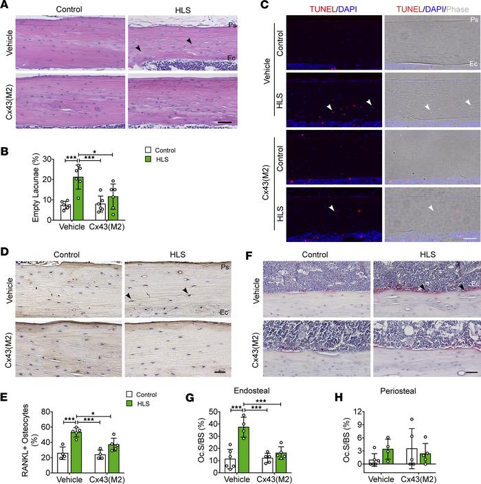Enhanced Cx43 HC activity by Cx43(M2) inhibits osteocyte apoptosis and o...