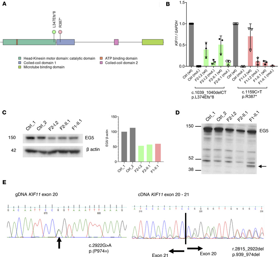 Reduced expression of KIF11 (EG5) and splicing abnormalities suggest hap...