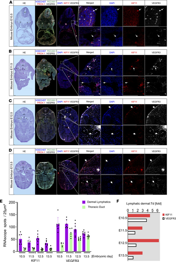 
Kif11 coexpression with Flt4-positive lymphatic vessels during mouse em...