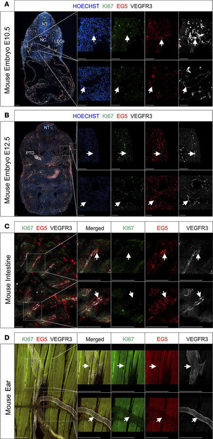 EG5 protein coexpression with VEGFR3-positive lymphatic vessels during m...