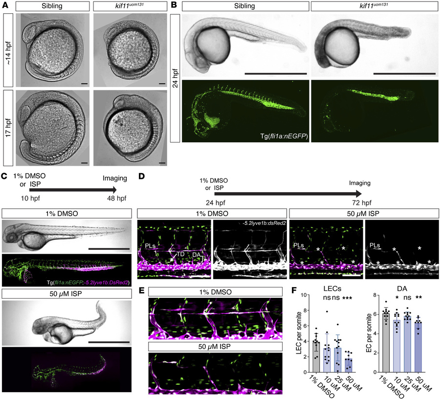 Genetic and pharmacological loss of kif11 results in abnormal embryonic ...